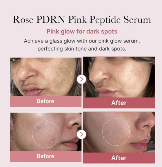 Medicube - PDRN Pink Peptide Serum